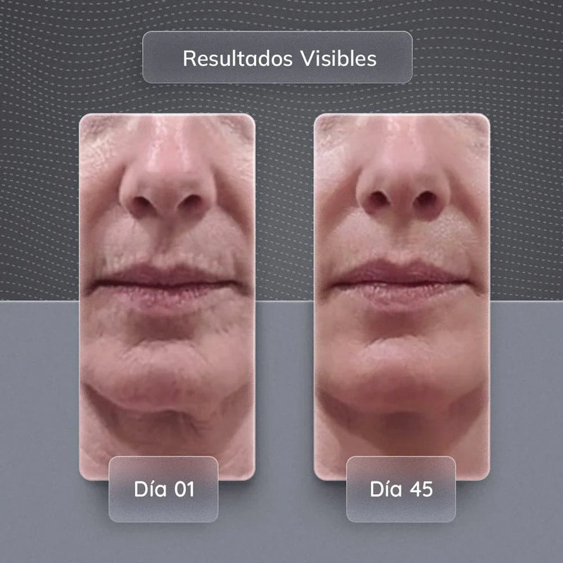 Skindion - Rejuvenecimiento Facial y Antiarrugas